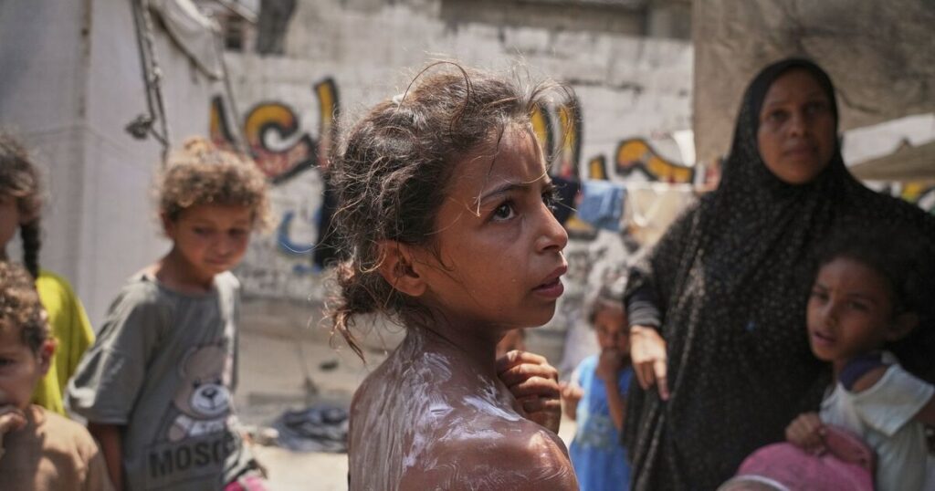 Palestinians say 36 people killed trying to obtain desperately needed aid