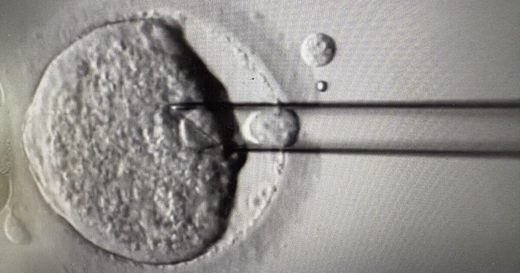 Eight babies born from pioneering IVF technique to prevent devastating disease