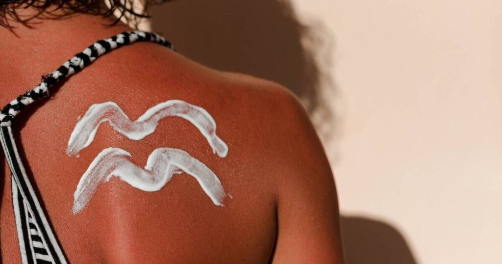Too much sun exposure over the weekend? Here are five ways to soothe sore sunburns